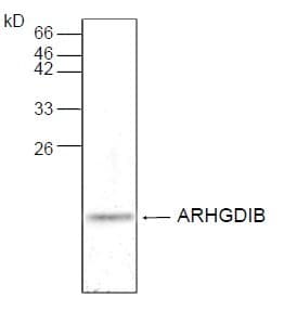 Monoclonal Mouse anti-Human FZD7 / Frizzled 7 Antibody (WB)