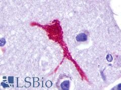 PathPlus™ C5AR2 / GPR77 / C5L2 Antibody (Extracellular Domain)