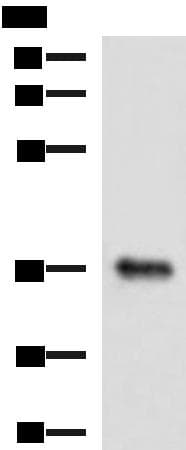 GRHPR / Glyoxylate Reductase Antibody