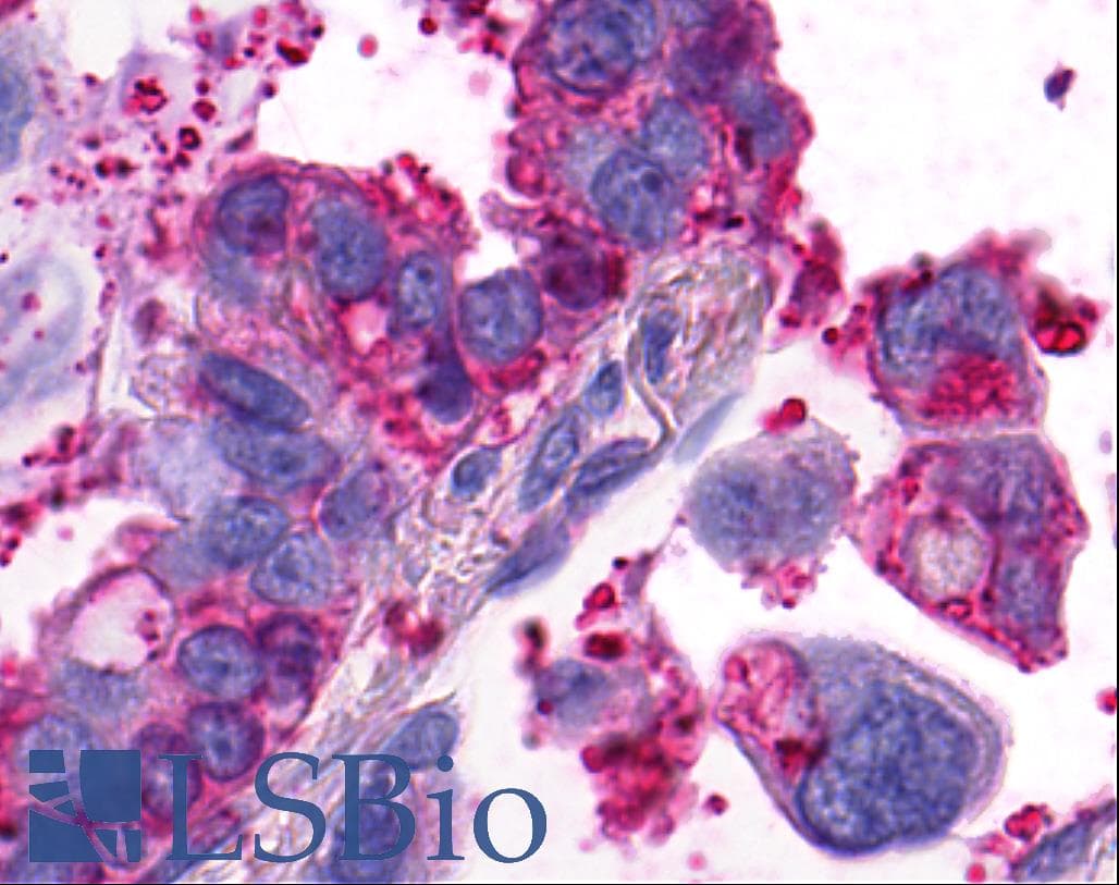 PathPlus™ Polyclonal Rabbit anti-Human GPR4 Antibody (Extracellular Domain, IHC)