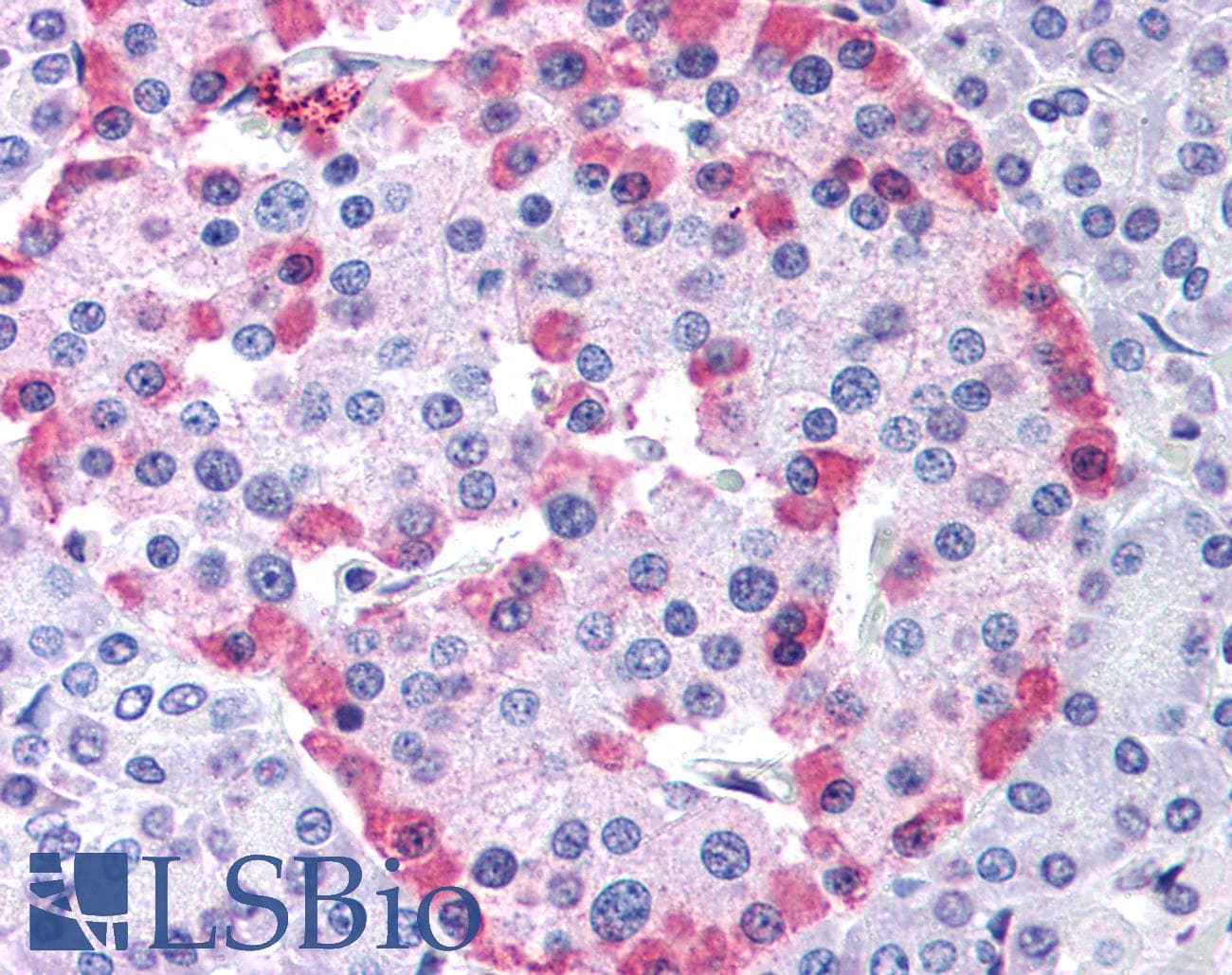 IHC-plus™ Polyclonal Rabbit anti-Human GLP1R / GLP-1 Receptor Antibody (Cytoplasmic Domain, IHC)