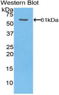 THBS4 / Thrombospondin 4 Antibody (aa644-925)