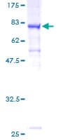 Human MTMR14 Protein (Recombinant GST)