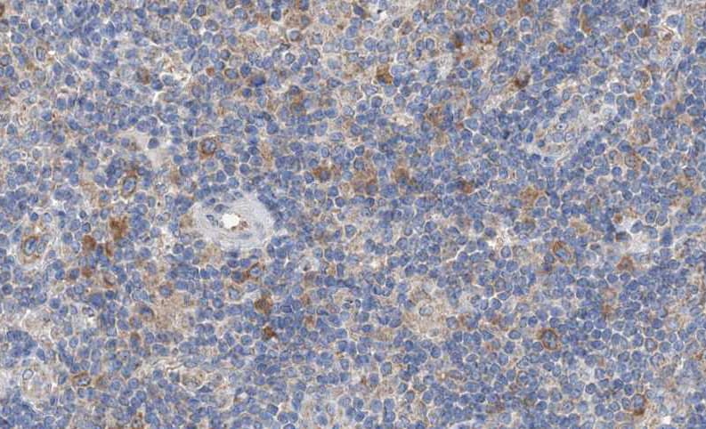 ZIF268 / EGR1 Antibody