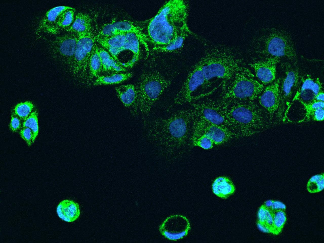Polyclonal Rabbit anti-Human ALDH5A1 Antibody (IHC, IF)