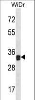 LGALS9 / Galectin 9 Antibody (aa62-90)