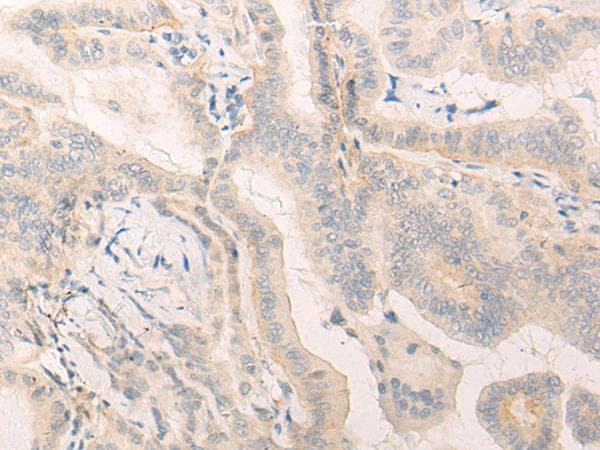 HNE / Neutrophil Elastase Antibody