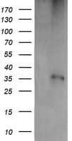 CD1C Antibody (clone OTI1H9)