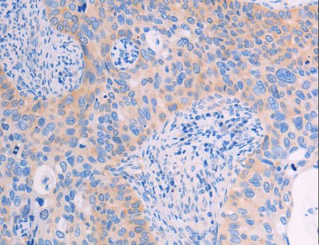 ADHFE1 Antibody