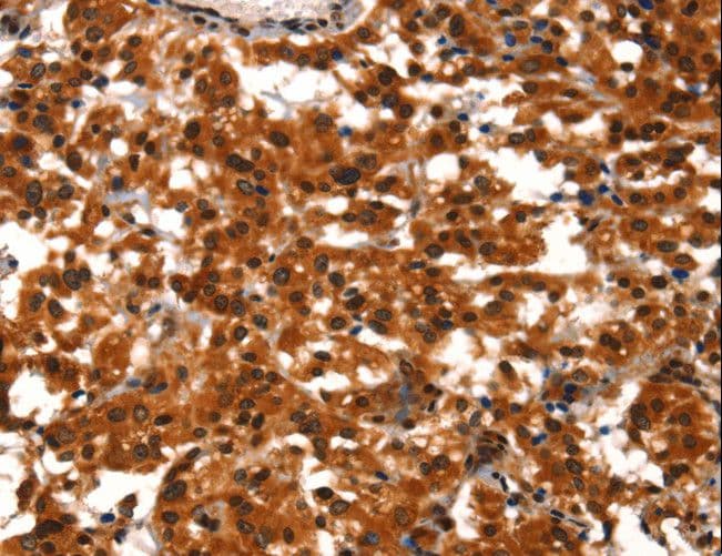 BCAS3 Antibody