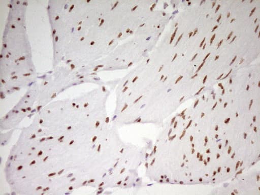 MEF2D Antibody (aa1-282, clone OTI1E11, Carrier-free)
