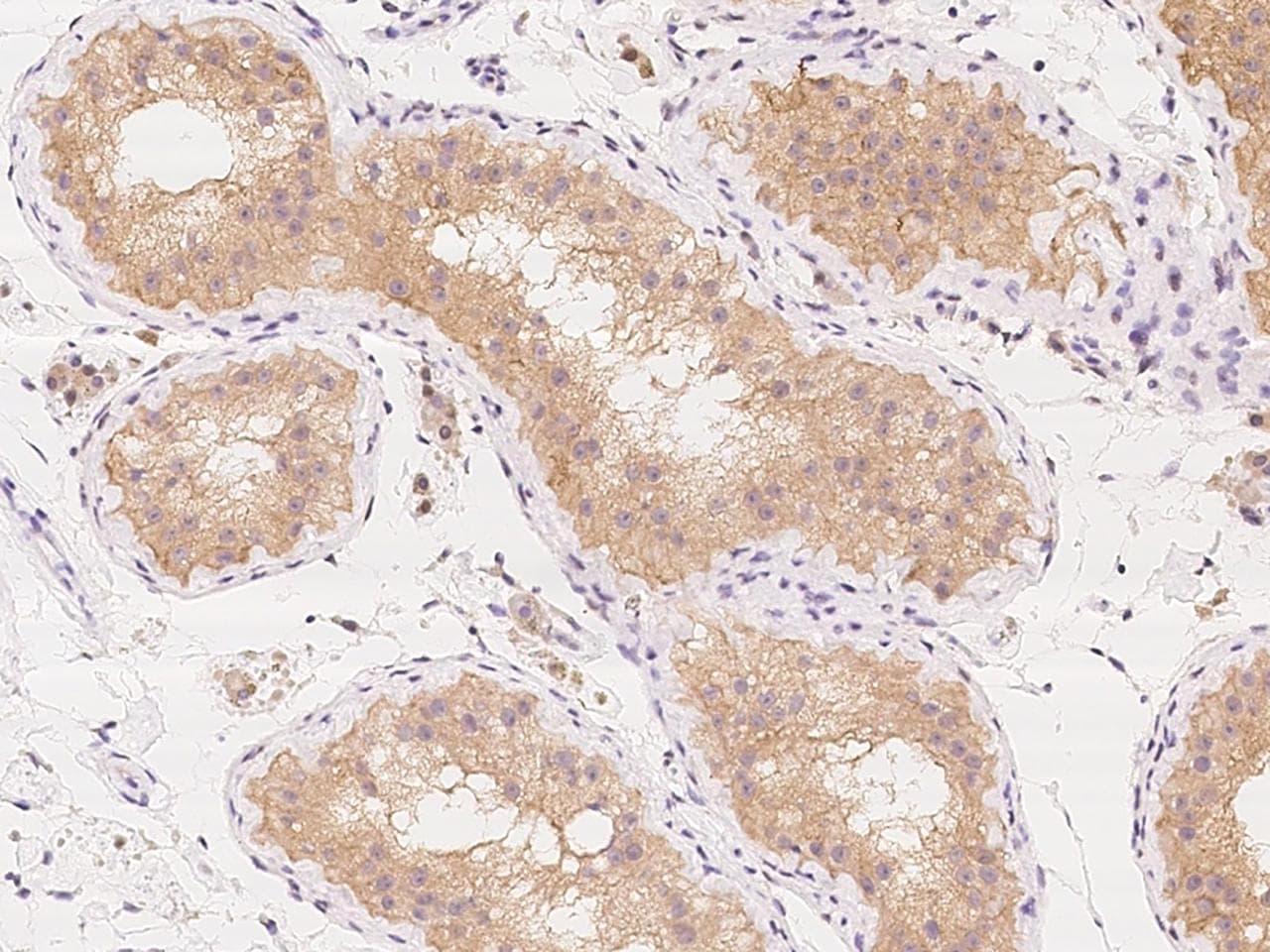 KLHL17 Antibody