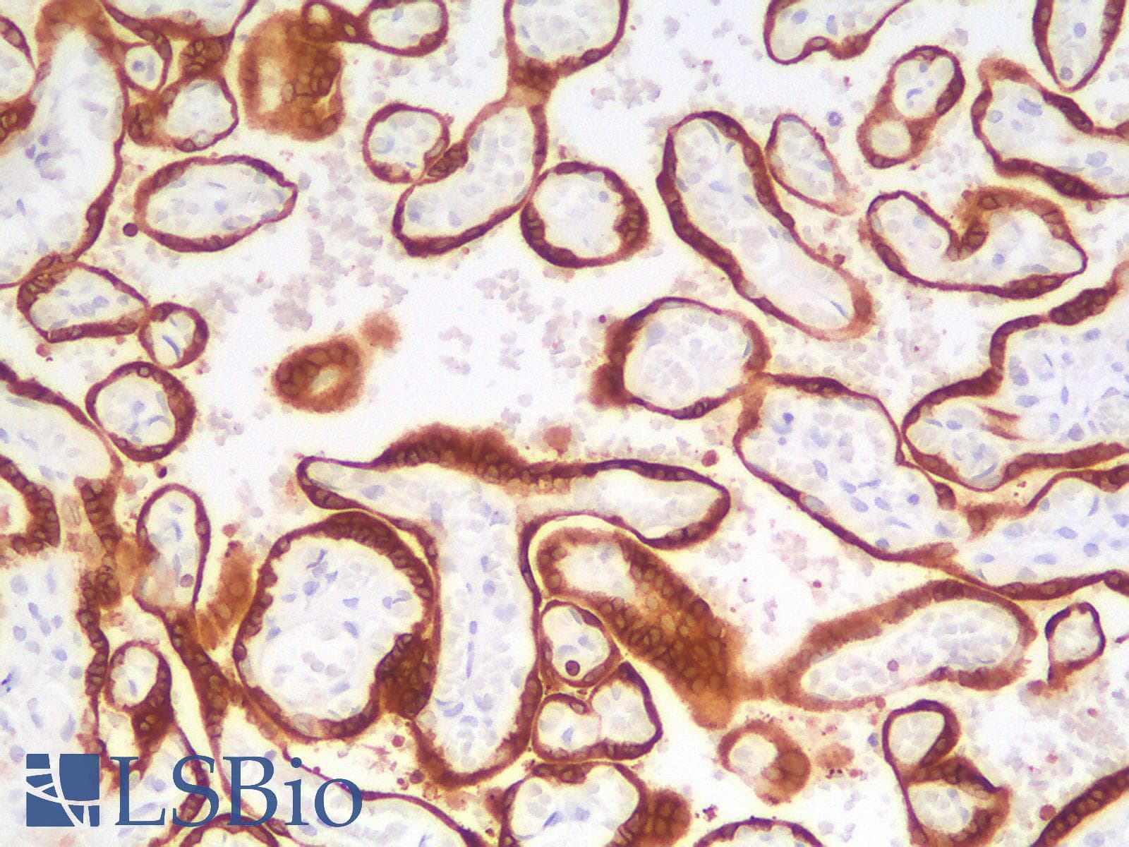 PathPlus™ BCL2 / Bcl-2 Antibody (clone rBCL2/782)