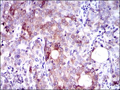 SLC27A5 / BACS Antibody (aa508-570, clone 9C4D1)