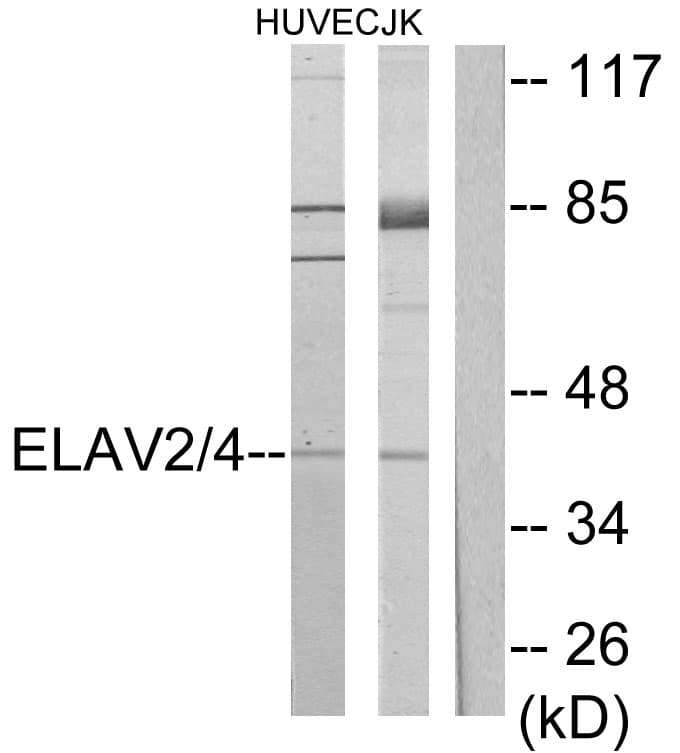ELAV Like / ELAVL2 + ELAVL4 Antibody (Internal)