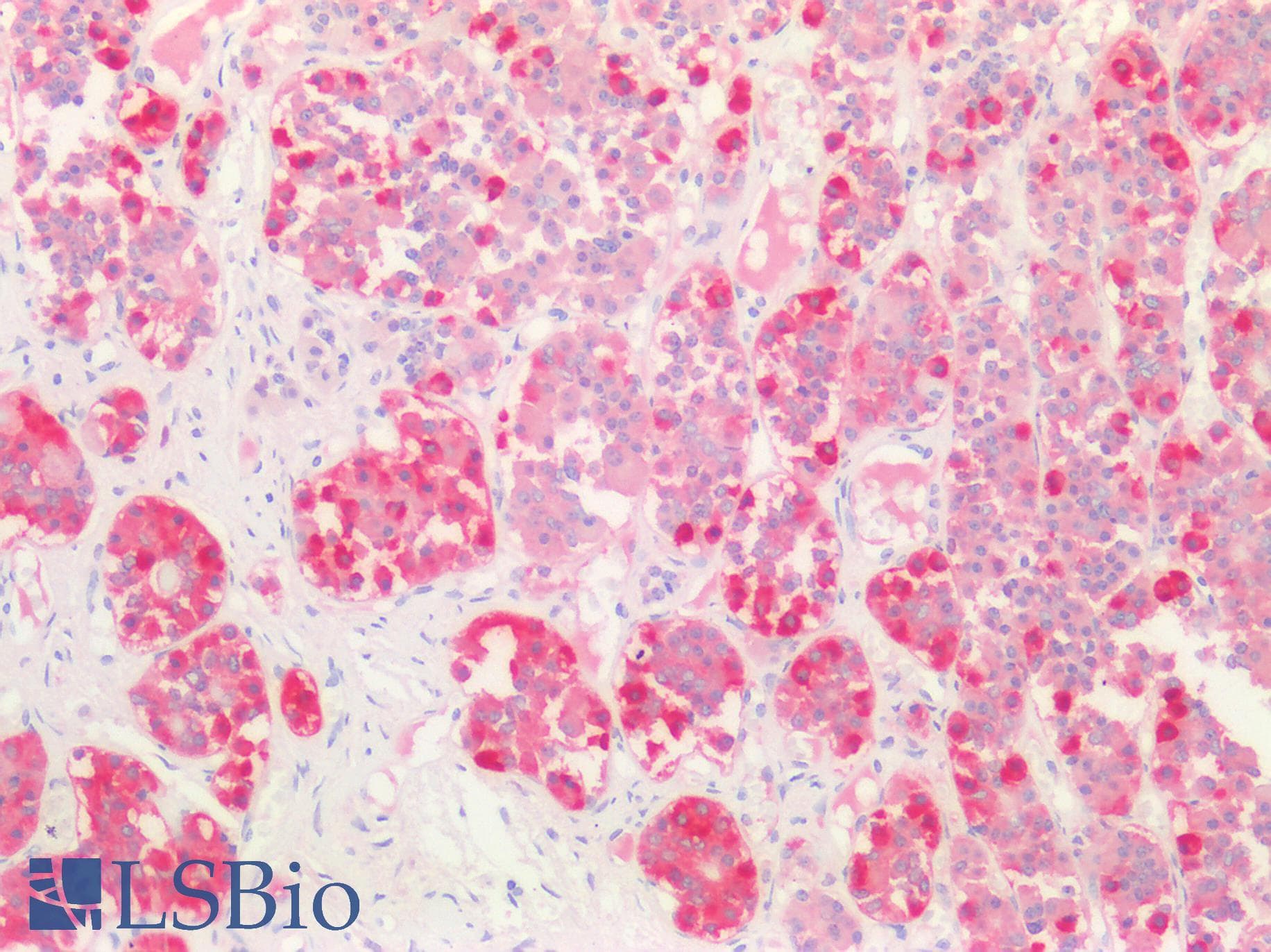 PathPlus™ Monoclonal Mouse anti-Human FSHB / FSH Beta Antibody (clone 365CT24.1.1, aa36-64, IHC, WB)