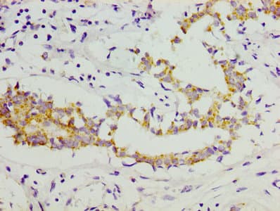 Polyclonal Rabbit anti-Human COL11A1 / Collagen XI Alpha 1 Antibody (WB)
