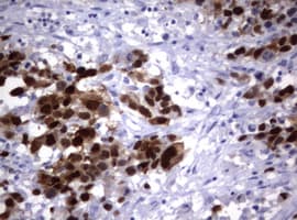PathPlus™ TS / Thymidylate Synthase Antibody (clone 3F1)