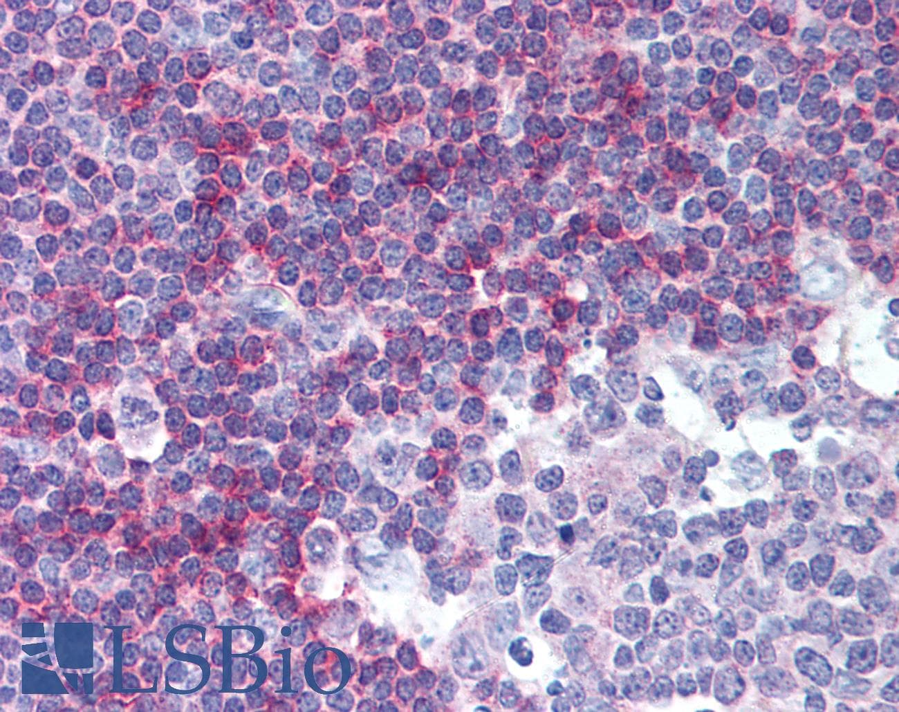 IHC-plus™ BAFF Receptor / CD268 Antibody (clone 11C1)