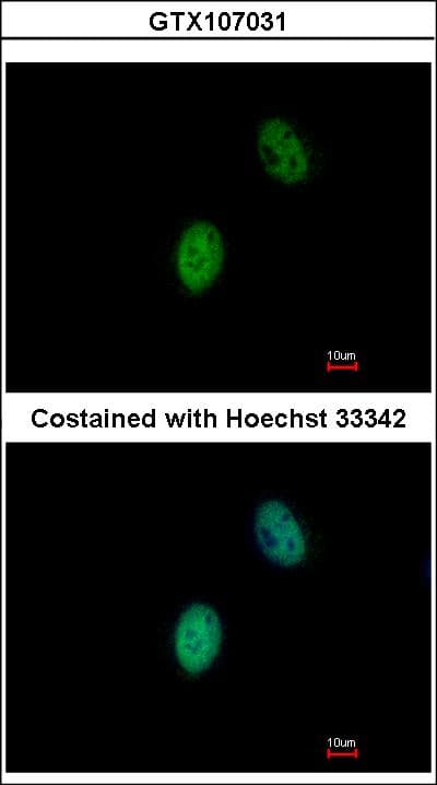 IHC-plus™ FHL5 Antibody (aa1-226)
