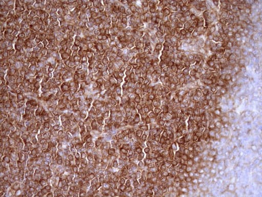 RPL10 / Ribosomal Protein L10 Antibody (clone OTI6B11)