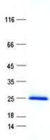Human MAX Protein (Recombinant His, N-Terminal)