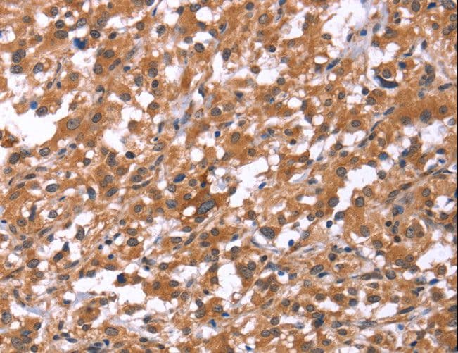 HSD17 / HSD17B1 Antibody