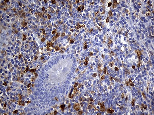 Monoclonal Mouse anti-Human UBE3B Antibody (clone OTI3F10, aa768-1068, IHC)