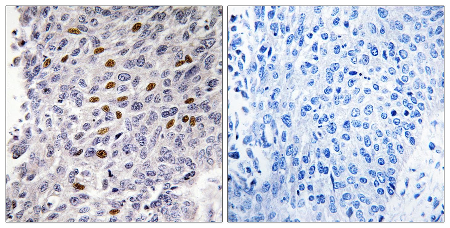 ATF1 Antibody (p63)