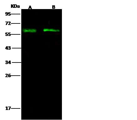 Polyclonal Rabbit anti-Human SPN / CD43 Antibody (Preservative Free, WB)