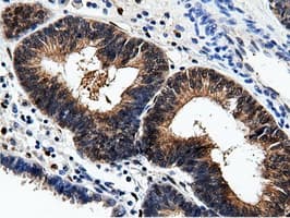 AK5 / Adenylate Kinase 5 Antibody (clone OTI2A2)