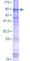 Human ADGRL4 / ELTD1 Protein (Recombinant GST)