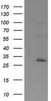 EXOSC7 Antibody (clone OTI1E8)