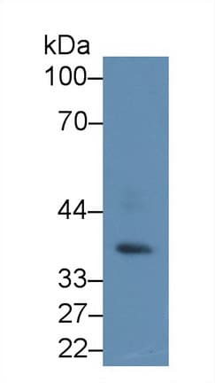 PRKAG1 / AMPK Gamma 1 Antibody (aa70-300)