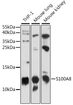Polyclonal Rabbit anti-Human S100A8 / MRP8 Antibody (WB)