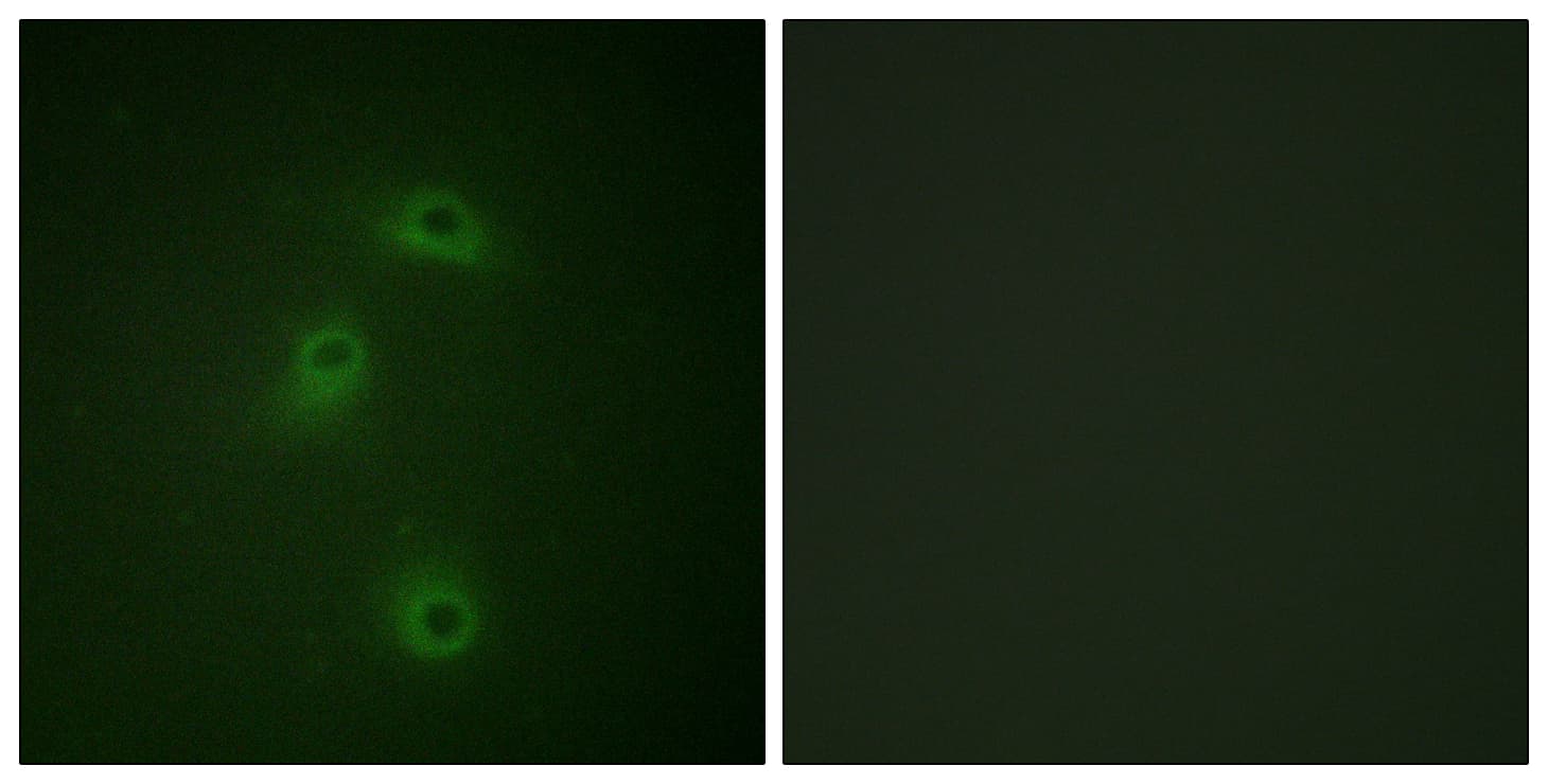 DAPK2 / DAP Kinase 2 Antibody (phospho-Ser318)