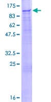 Human DCAF6 / NRIP Protein (Recombinant GST)