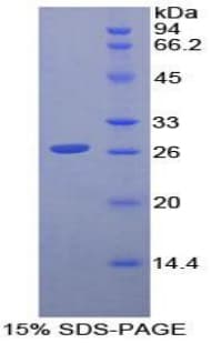 Mouse CD79B / CD79 Beta Protein (Recombinant His-T7)