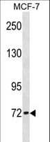 CPT2 Antibody (aa212-241)