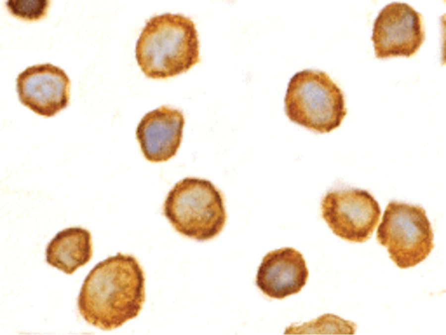 IHC-plus™ TOLLIP Antibody