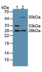 Adiponectin Antibody (aa111-244)