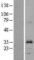 HSD11B1L Protein (Over-Expression Lysate Myc-DDK (Flag))