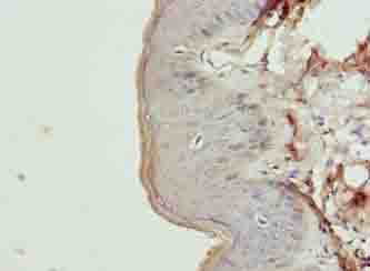 Polyclonal Rabbit anti-Human KRT35 / Keratin 35 / KRTHA5 Antibody (aa1-455, IHC, WB)