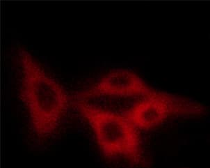 Polyclonal Rabbit anti-Human STMN1 / Stathmin / LAG Antibody (phospho-Ser15, IHC, IF, WB)