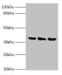 TMOD3 / Tropomodulin 3 Antibody (aa1-352)