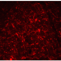 Polyclonal Rabbit anti-Human TSLP Antibody (IHC, IF, WB)