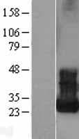 ARF5 Protein (Over-Expression Lysate Myc-DDK (Flag))