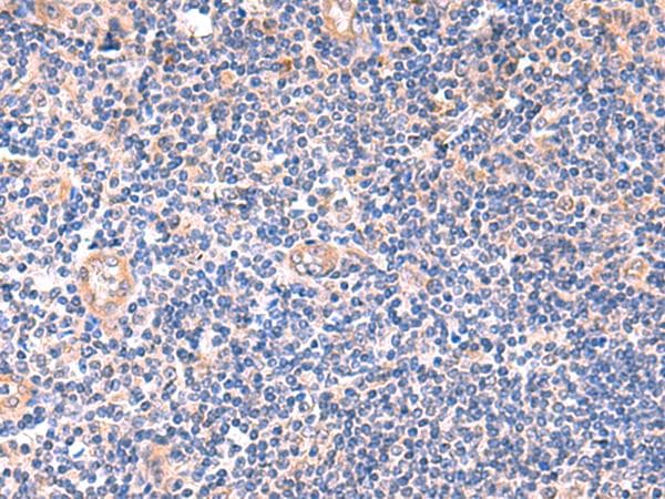 ZNF256 Antibody