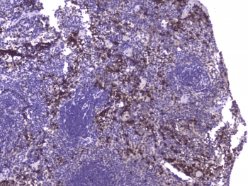 CCL8 / MCP2 Antibody