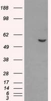 ATP5B / ATP Synthase Beta Antibody (clone OTI6B11)